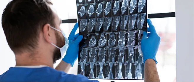 Seguro para Técnico de Radiologia